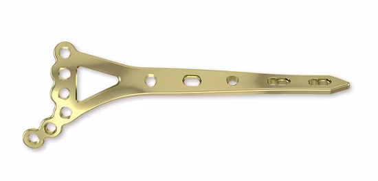 Femur Locking Plate Titanium Medical Plates Surgical Implants, Locking Plate, Medical Equipment